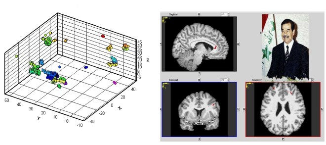 Activation patterns during interrogation concerning recognition of the face of Saddam Hussein. Image: Courtesy MMT Neurotech.
